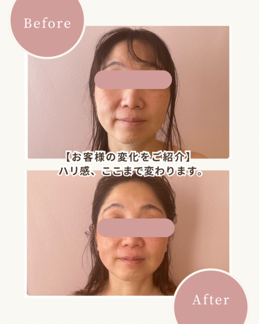 小顔への最短ルートは、緩めること。